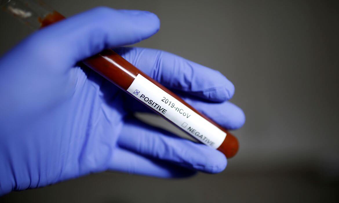 2020-03-06t164938z_1302835711_rc2gef9lky3t_rtrmadp_3_health-coronavirus-cruiseships