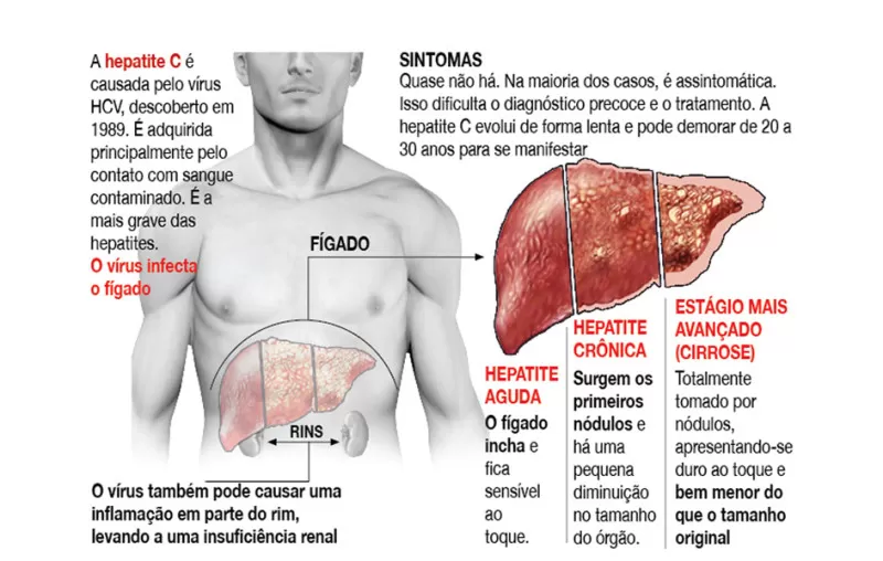 HepC