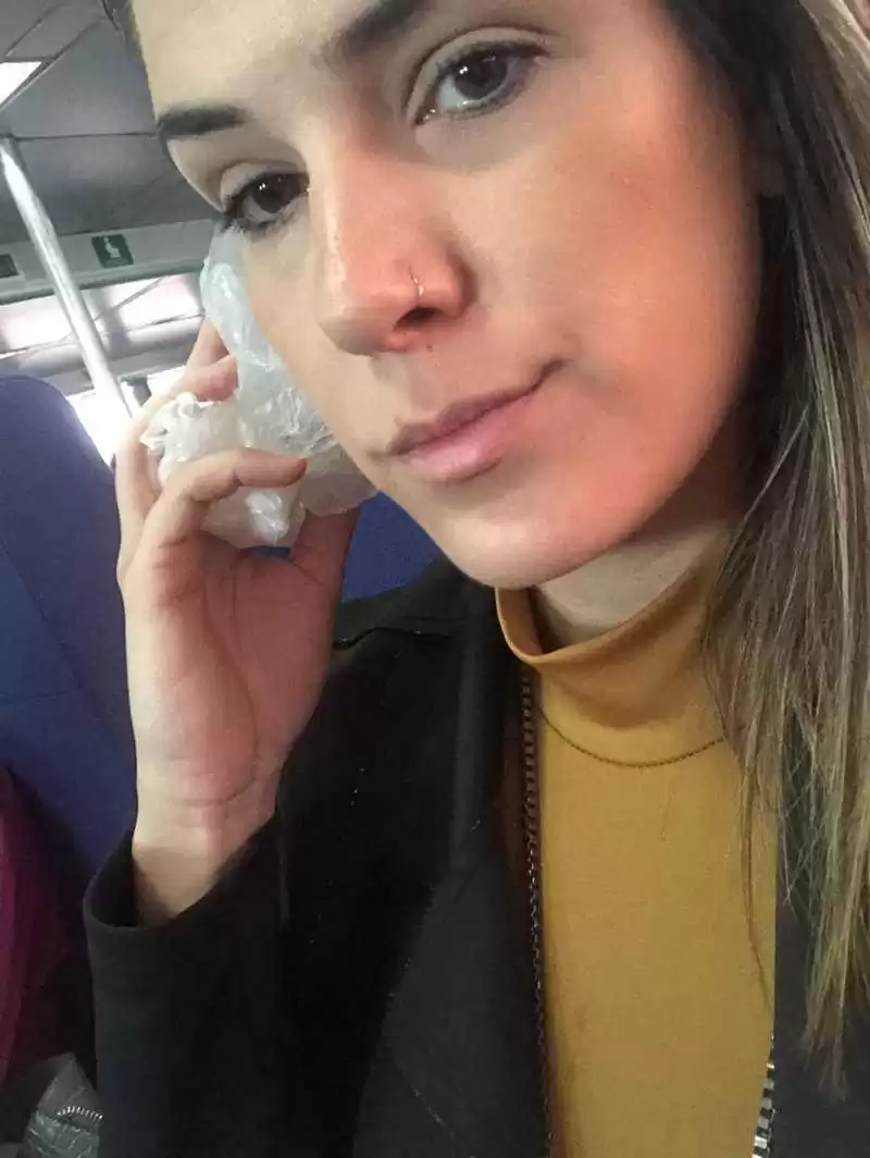 MULHER-AGREDIDA-POR-MORADORA-DE-RUA_00058772_0